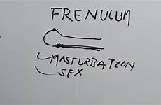 frenulum penile