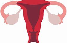 condom uterus cervix inflation