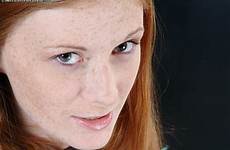 allison wyte freckles redheads