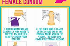 condom sexually insert infections contraceptives transmitted sti