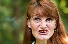 teeth bad cancer crooked ugly treatment stock health smile tooth woman depositphotos but decay person female british worker when 1st