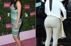kim butt fake kardashian before after surgery plastic women butts kardashians bikini young girls completely prove shocking body real khloe