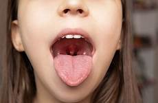 oral cancer mouth need signs