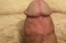 head cock penis closeup