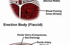 erection weak erectile dysfunction causes normal premature ejaculation penis anatomy process cause men impotence if emedicinehealth treatment libido larger click