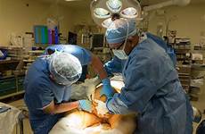 hernia surgery scrotal