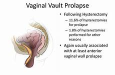 prolapse pelvic organ vaginal vault female uterine hysterectomy wall often ant post cause ppt hysterectomies other