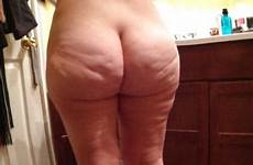 cellulite ass asses