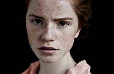 redheads freckles