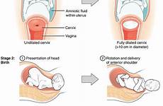 childbirth stages afterbirth dilation