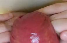 prolapse anal video thisvid rating