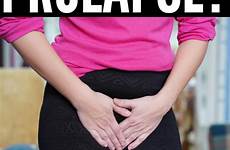 prolapse exercises organ pelvic treatments floor prolapsed uterus uterine merakilane help treatment exercise pregnancy therapy