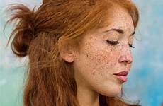 over redheads prove stunning unique beauty world freckles london sophee california usa