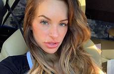 kimmy granger forehead