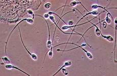 microscope sperms 1000x millilitre alarming distrust decline