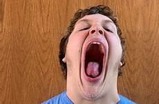 gape mouth largest world pennsylvania teen has record