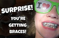braces surprise