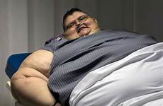 wereld ter dikste zwaarste kilo fattest gros obeso mexicain geopereerd redden heaviest vaincu leven