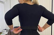 cathy evans bbl sight rotund liposuction transfers whittled rear