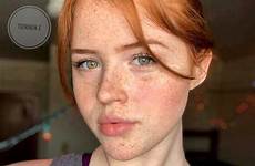 freckles freckledgirls