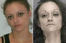 meth crystal after before addict aged rehab shocking left right junkies