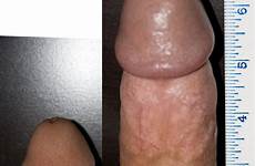 penis erect erected flaccid xxgasm