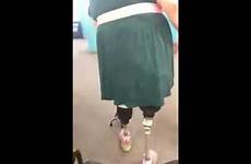 amputee walking dak knee above bilateral prosthetic legs