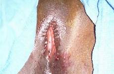 tumblr tumbex female cut circumcision uncut sexy