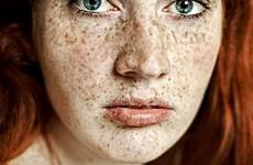 freckles redheads redhead pecas