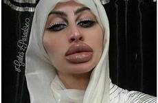 surgery plastic fails big irreversibly scary when girls lips irreversible freak turned straight total into show lip cosmetic bad choose