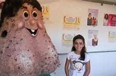 testicle nutsack cancer mascot balls giant cursed mr comments cursedimages brazil promote creates research prev