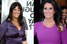 before after surgery patti stanger reduction boob job breast breasts plastic boobs big also her