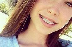 freckles braces tween myteenwebcam brace hustler selfshot teenager