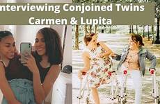 carmen lupita conjoined twins herrin