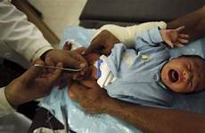 circumcision circumcise circoncision loses sons indianexpress