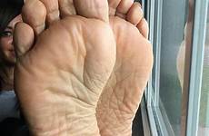 soles wrinkles canady deep