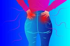 buttock arthritis buttocks causing creakyjoints painful clues gluteal