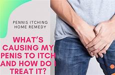 penis pennis itching itch do remedy