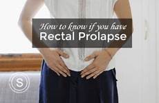 prolapse rectal rectum prolapsed gastroenterology anus protrudes