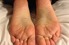 wrinkled soles barefoot