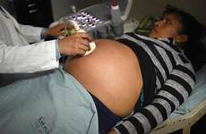 pregnant women should woman gets afp cdc exposure zika assessed guatemala ultrasound after