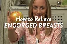 engorged breasts relieve breastfeeding cloudmom breast visit motherhood
