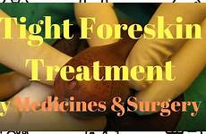 foreskin tight circumcision treatment surgery