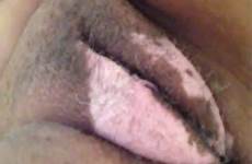 pussy vitiligo tonned two shesfreaky momments tagged