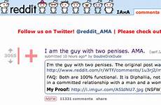 penises two man reddit body people parts life guy has extra ama sex who blew mind internet did questions lockerdome