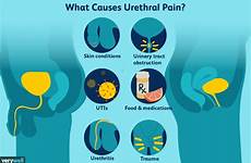 urethral urethra urethritis verywell verywellhealth