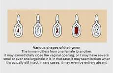 hymen does look why