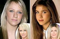 nose aniston rhinoplasty