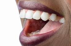 bouche africaine africana dientes dents femelle montrant perfectos femenina archivo