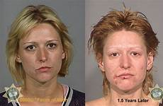 meth after before users addicts faces side woman fact horrifying